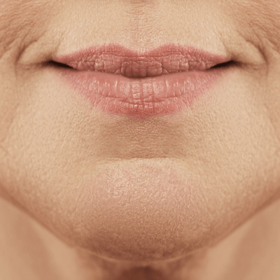 2.5% Retinol Moisturizer guide