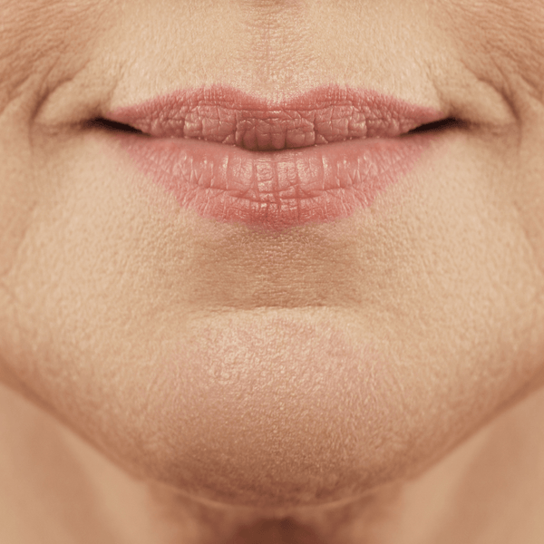 2.5% Retinol Moisturizer guide