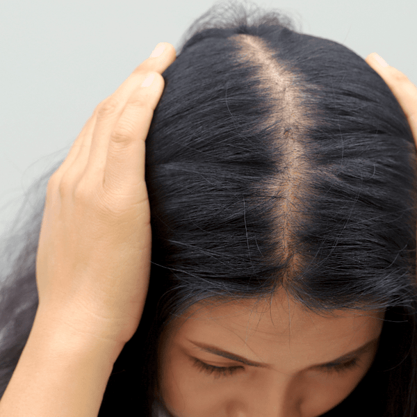 Why Is My Hair Falling Out? Causes and Simple Tips