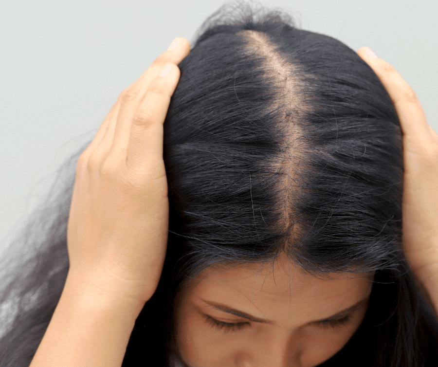 Why Is My Hair Falling Out? Causes and Simple Tips