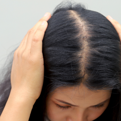 Why Is My Hair Falling Out? Causes and Simple Tips