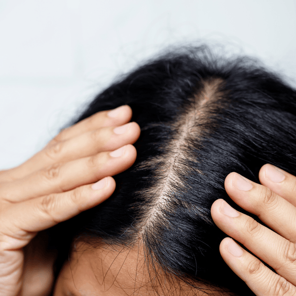 Best peptides for creasing skin?