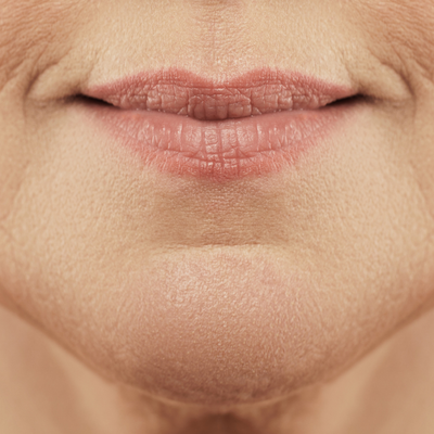 Cheapest peptide boosters for wrinkles?