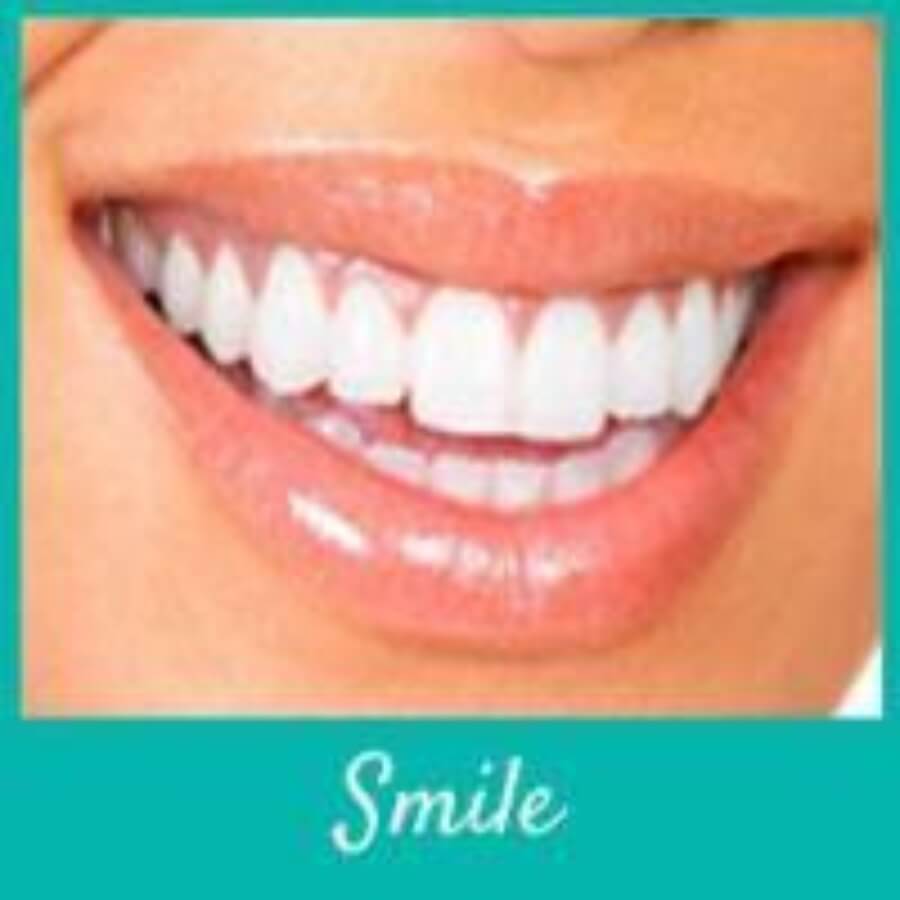 White Teeth for a Younger-Looking Smile