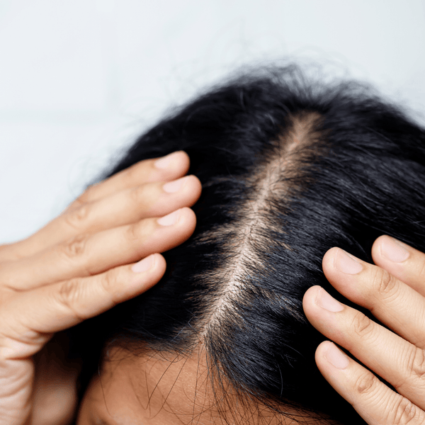 natural remedies for puffy eyes on wedding morning