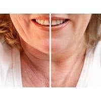 Sagging Neck and Jowls - Skin Perfection Natural and Organic Skin Care