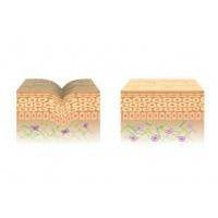 Collagen Stores and Smooth Skin