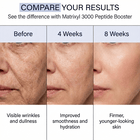 compare the difference between other brand's serums and Skin Perfection's Matrixyl 3000 Serum Booster